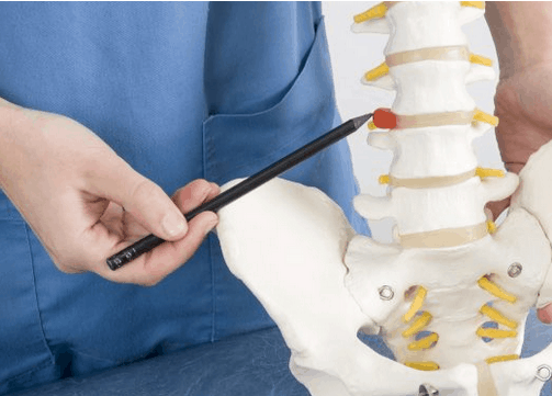 Arquivos cirurgia da coluna  Clínica Ortho Spine Clínica Ortopédica na  Barra da Tijuca